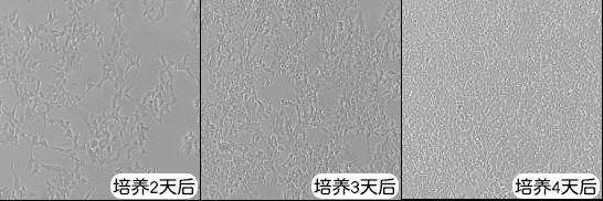 HEK293T細(xì)胞培養(yǎng)過程中的不同密度情況